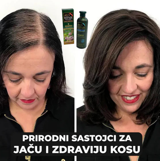 Šampon sa Ekstraktom Bijelog Luka