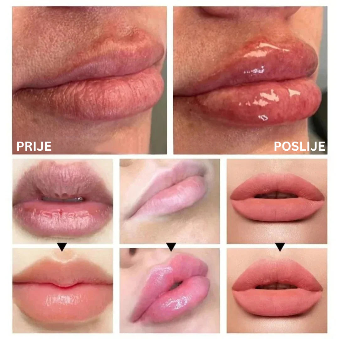LIP PLUMPER za Punije i Sjajnije Usne 1+1 GRATIS